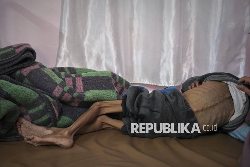 326 Meninggal Kelaparan, 300 Keguguran Akibat 80 Hari Blokade Israel di Gaza